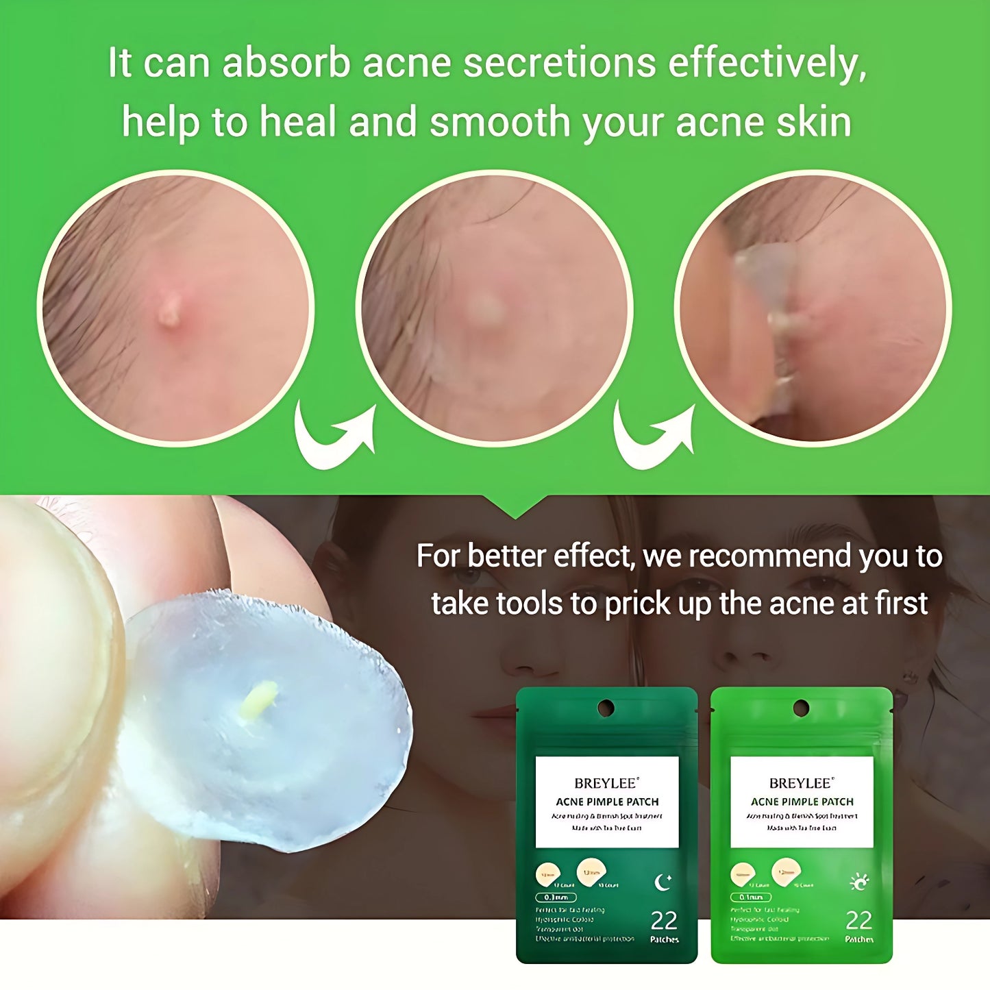 Tea Tree Acne Pimple Patches | Fast Healing by GlowThera